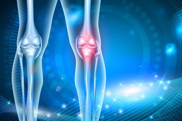 Boyun Osteoartriti — Sebepleri, Belirtileri ve Tedavi Yöntemleri