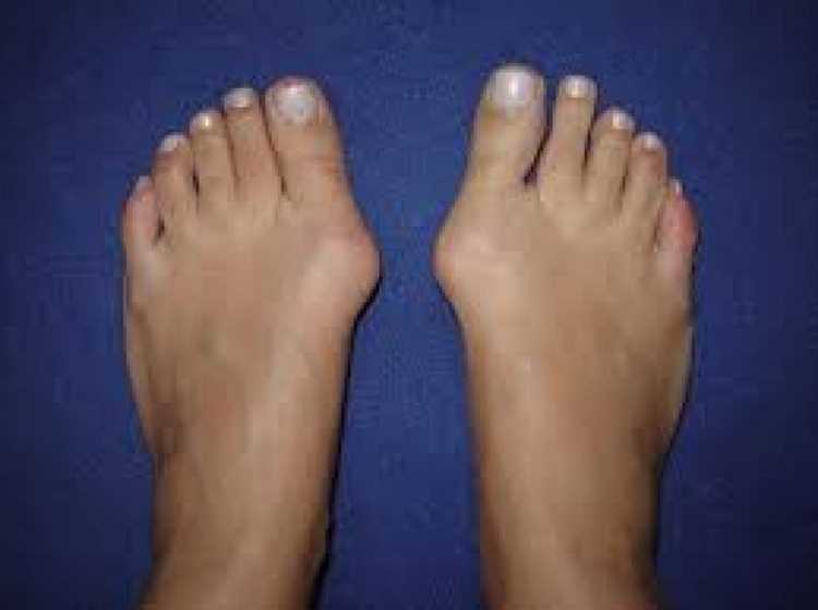 Ayak baş parmağındaki ağrıyı tetikleyen hastalıklar