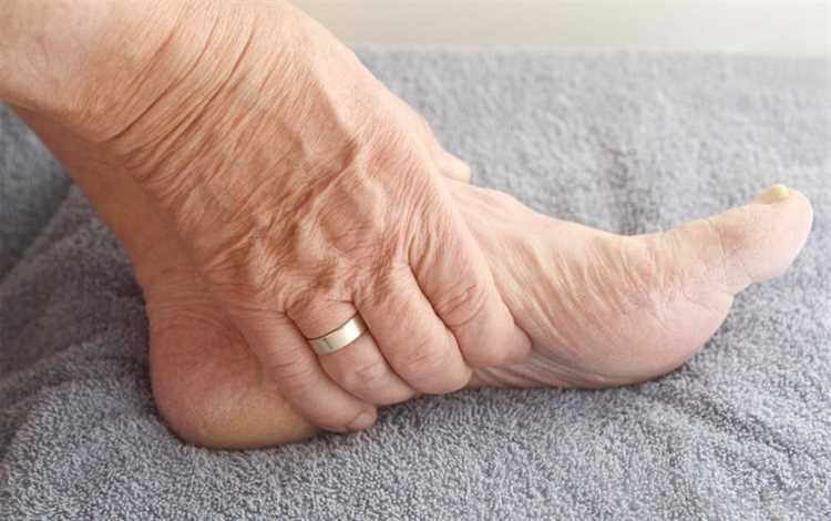  Ayak Eklem Hastalıklarında Artroz 