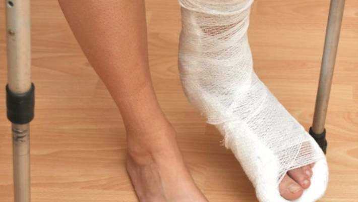 Ayak kırığı: nedenleri, belirtileri, tedavisi ve iyileşme süresi