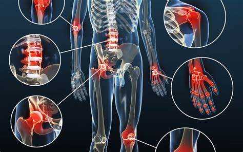 Ayak osteoartriti: Nedenleri, Belirtileri ve Tedavi Yöntemleri