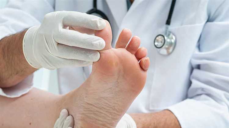 Ayak topuğu ve ayak arasındaki ağrılar: Nedenleri, belirtileri ve tedavi yöntemleri
