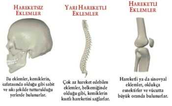 Şiddetli ağrı kesiciler