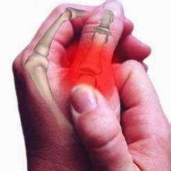Ellerinizin parmak bükme ile oluşan ağrısı nasıl tedavi edilir?
