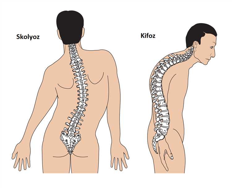 Kostalı-omurga eklemi osteoartriti | Tedavi yöntemleri ve semptomları
