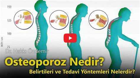 Osteofitler Nedir? - Osteofitlerin Belirtileri, Nedenleri ve Tedavi Yöntemleri