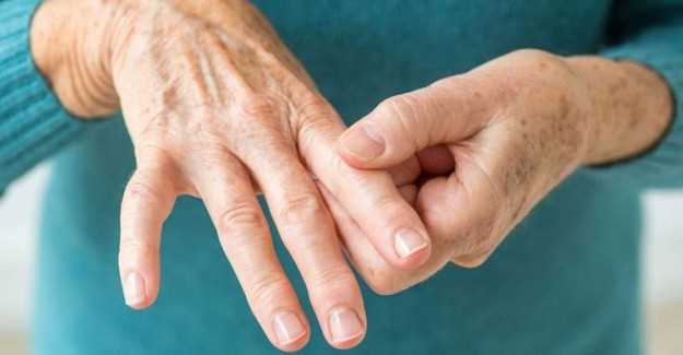 Psoriatik Artrit: Tanı, Tedavi ve Semptomlar