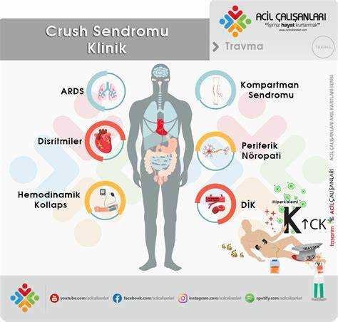 Reiter Sendromu: Nedenleri ve Evreleri