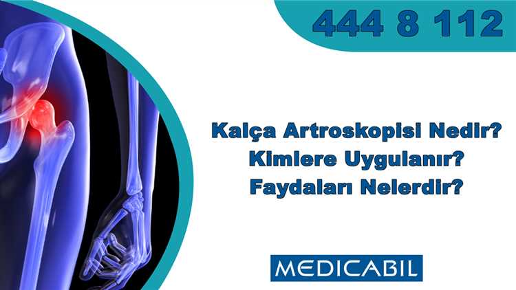 Artroplasti Operasyonunun Olası Komplikasyonları