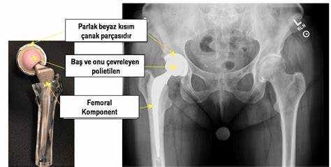 Kalça eklemi röntgeni nerede yapılır?